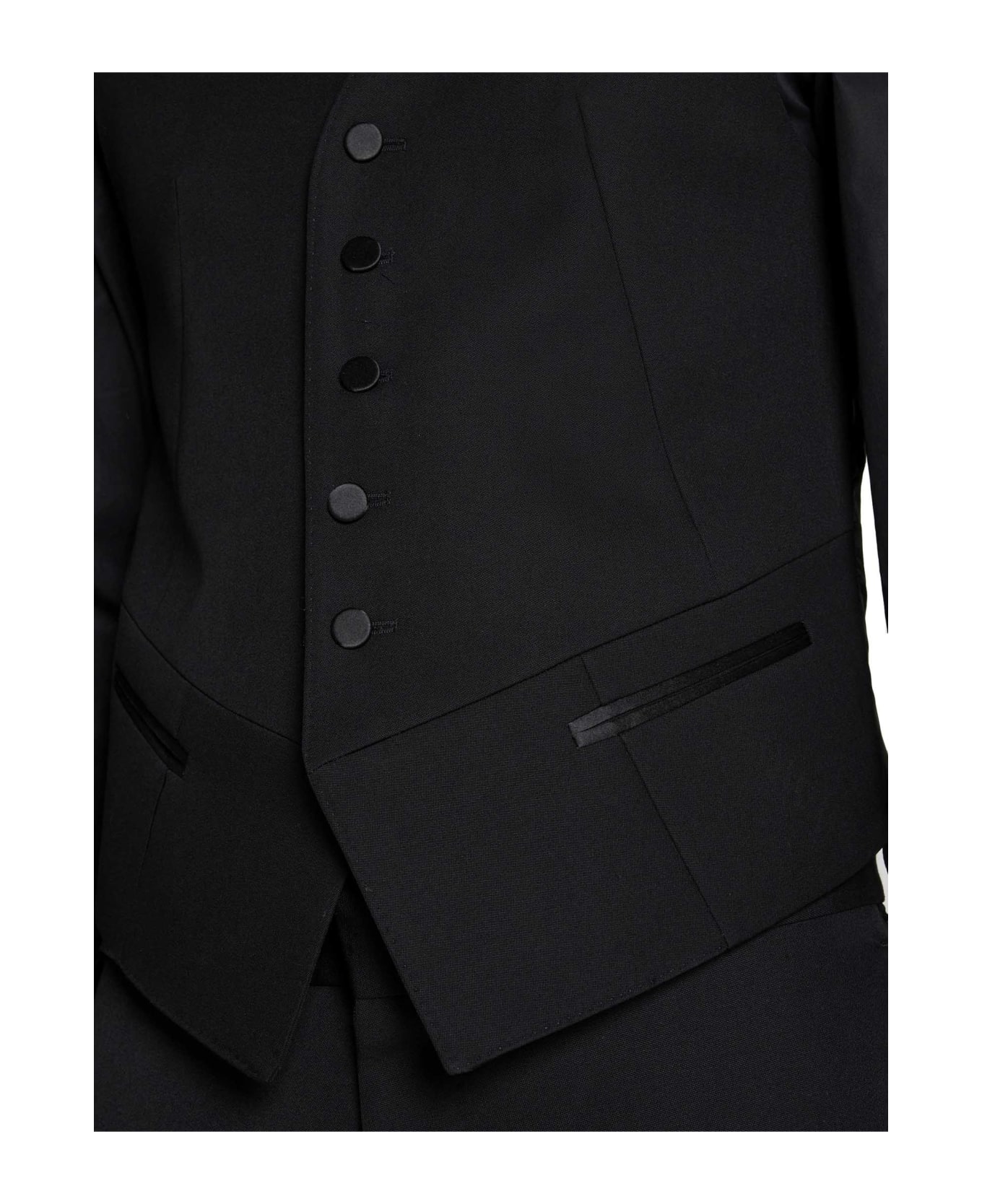 Alexander McQueen Vest - Black