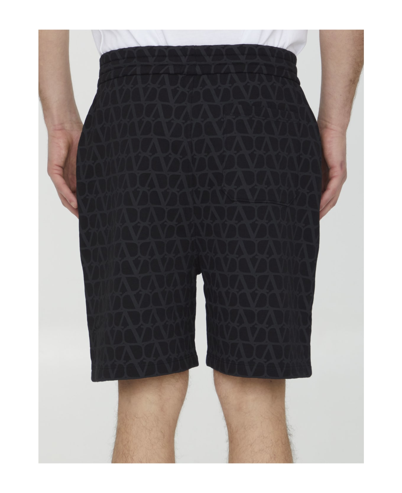 Valentino Toile Iconographe Cotton Bermuda Shorts - Black ショートパンツ